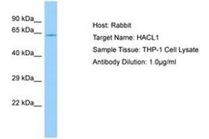Image no. 1 for anti-2-Hydroxyacyl-CoA Lyase 1 (HACL1) (AA 102-151) antibody (ABIN6750107) (HACL1 antibody  (AA 102-151))
