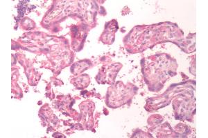 Human Placenta: Formalin-Fixed, Paraffin-Embedded (FFPE) (BDKRB1 antibody  (C-Term))