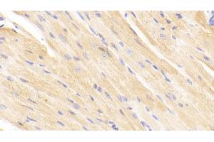 Detection of TIMP2 in Mouse Cardiac Muscle Tissue using Polyclonal Antibody to Tissue Inhibitors Of Metalloproteinase 2 (TIMP2) (TIMP2 antibody  (AA 27-220))