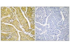Immunohistochemistry (IHC) image for anti-Cytochrome P450, Family 2, Subfamily D, Polypeptide 6 (CYP2D6) (Internal Region) antibody (ABIN1852661) (CYP2D6 antibody  (Internal Region))