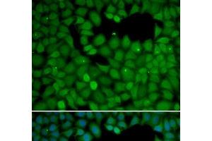Immunofluorescence analysis of HeLa cells using NET1 Polyclonal Antibody (NET1 antibody)