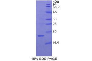 SDS-PAGE (SDS) image for Retinol Binding Protein 2, Cellular (RBP2) (AA 1-134) protein (His tag) (ABIN2122015)