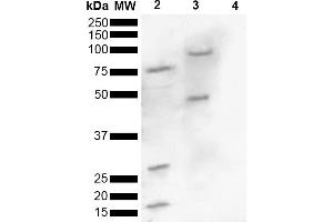 Western blot analysis of Human, Mouse brain lysate showing detection of ~16 kDa Alpha Synuclein pSer129 protein using Rabbit Anti-Alpha Synuclein pSer129 Polyclonal Antibody (ABIN5650949). (SNCA antibody  (pSer129) (HRP))