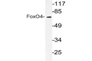 Western blot (WB) analyzes of FoxO4 antibody in extracts from COLO205 cells. (FOXO4 antibody)