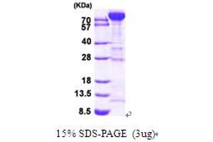 SDS-PAGE (SDS) image for phosphofructokinase, Muscle (PFKM) (AA 1-780) protein (His tag) (ABIN667782)