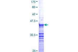 CDC20 Protein (AA 1-100) (GST tag)