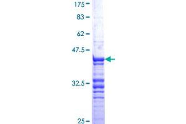 CDC20 Protein (AA 1-100) (GST tag)