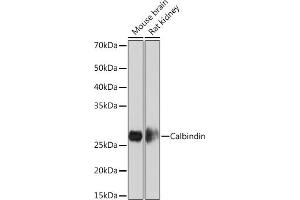 Western blot analysis of extracts of various cell lines, using Calbindin Rabbit mAb (ABIN1679483, ABIN3018777, ABIN3018778 and ABIN7101660) at 1:1000 dilution.