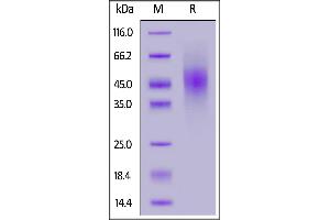Human FGFR2 (IIIb), His Tag on  under reducing (R) condition.