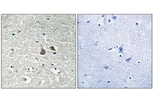 Immunohistochemical analysis of paraffin-embedded human brain tissue using IRAK1 (Phospho-Ser376) antibody (left)or the same antibody preincubated with blocking peptide (right). (IRAK1 antibody  (pSer376))