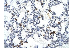 Rabbit Anti-E2F6 antibody        Paraffin Embedded Tissue:  Human Lung cell   Cellular Data:  Epithelial cells of renal tubule  Antibody Concentration:   4. (E2F6 antibody  (Middle Region))