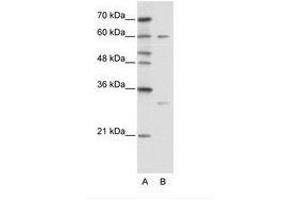 Image no. 1 for anti-Zinc Finger Protein 395 (ZNF395) (AA 361-410) antibody (ABIN6736114) (ZNF395 antibody  (AA 361-410))