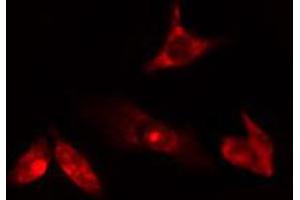 ABIN6274763 staining HuvEc cells by IF/ICC. (AZI1 antibody  (C-Term))