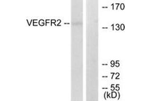 Western blot analysis of extracts from 293 cells, treated with LPS 100ng/ml 30', using VEGFR2 (Ab-1214) Antibody. (VEGFR2/CD309 antibody  (AA 1180-1229))