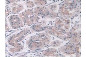 IHC-P analysis of Human Stomach Tissue, with DAB staining. (KEAP1 antibody  (AA 327-624))