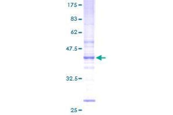 UBE2W Protein (AA 1-159) (GST tag)