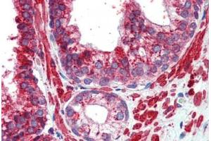 Human Prostate (formalin-fixed, paraffin-embedded) stained with TFAP2C antibody ABIN462192 followed by biotinylated goat anti-rabbit IgG secondary antibody ABIN481713, alkaline phosphatase-streptavidin and chromogen. (TFAP2C antibody  (AA 252-301))