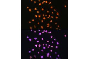 Immunofluorescence analysis of C6 cells using NR2F2 Rabbit pAb (ABIN6133831, ABIN6144820, ABIN6144821 and ABIN6214430) at dilution of 1:100. (NR2F2 antibody  (AA 1-100))