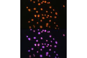 Immunofluorescence analysis of C6 cells using NR2F2 Rabbit pAb (ABIN6133831, ABIN6144820, ABIN6144821 and ABIN6214430) at dilution of 1:100. (NR2F2 antibody  (AA 1-100))