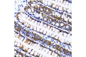 Immunohistochemistry of paraffin-embedded human colon using FASN antibody. (Fatty Acid Synthase antibody)
