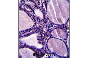 TRIM23 Antibody (N-term) (ABIN657564 and ABIN2846571) immunohistochemistry analysis in formalin fixed and paraffin embedded human thyroid tissue followed by peroxidase conjugation of the secondary antibody and DAB staining. (TRIM23 antibody  (N-Term))