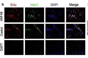 The relationships of the Wnt and Notch signaling pathway and the proliferation of epidermal stem cells was analyzed by immunofluorescence.