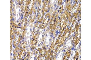 Immunohistochemistry of paraffin-embedded Rat kidney using ATP1A1 Polyclonal Antibody at dilution of 1:100 (40x lens). (ATP1A1 antibody)
