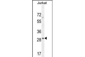 LRRC25 Antibody (C-term) (ABIN654519 and ABIN2844242) western blot analysis in Jurkat cell line lysates (35 μg/lane).