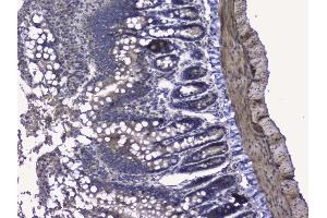 IHC analysis of RALBP1 using anti-RALBP1 antibody (ABIN5692936).