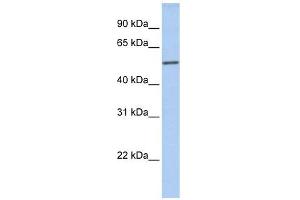 ICA1 antibody used at 1 ug/ml to detect target protein. (ICA1 antibody  (N-Term))