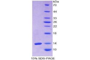 SDS-PAGE (SDS) image for Olfactomedin 4 (OLFM4) (AA 407-510) protein (His tag) (ABIN2121796)