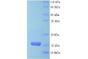 SDS-PAGE (SDS) image for Basic Leucine Zipper Transcriptional Factor ATF-Like 3 (BATF3) (AA 1-133), (full length) protein (His tag) (ABIN5713272) (BATF3 Protein (AA 1-133, full length) (His tag))