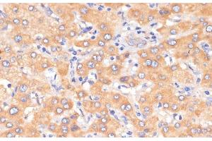 Immunohistochemistry of paraffin-embedded Human liver using PDCD2L Polyclonal Antibody at dilution of 1:100 (40x lens). (PDCD2L antibody)
