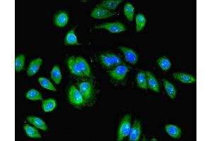 Immunofluorescent analysis of PC-3 cells using ABIN7168400 at dilution of 1:100 and Alexa Fluor 488-congugated AffiniPure Goat Anti-Rabbit IgG(H+L) (RBPMS antibody  (AA 1-219))