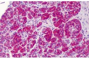 Human Pancreas: Formalin-Fixed, Paraffin-Embedded (FFPE) (FANCC antibody  (C-Term))