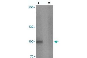 Western blot analysis of STOX1 in human liver tissue with STOX1 polyclonal antibody  at 1 ug/mL in (lane 1) the absence and (lane 2) the presence of blocking peptide. (STOX1 antibody  (C-Term))