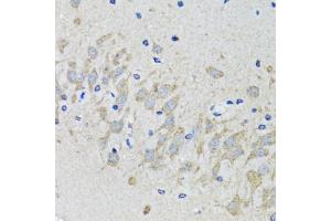 Immunohistochemistry of paraffin-embedded mouse brain using HTR2B antibody (ABIN1876871) at dilution of 1:100 (40x lens).