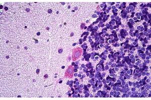 Rat Brain, Purkinje: Formalin-Fixed, Paraffin-Embedded (FFPE) (Arhgef9 antibody  (AA 274-303))