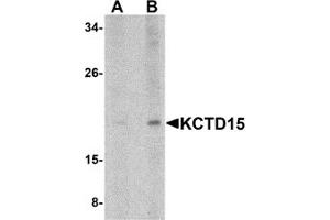 Western Blotting (WB) image for anti-Potassium Channel Tetramerisation Domain Containing 15 (KCTD15) (C-Term) antibody (ABIN1030466) (KCTD15 antibody  (C-Term))