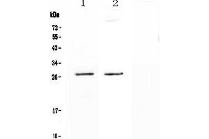 Western blot analysis of SPR using anti-SPR antibody .