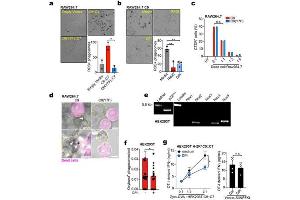 DNGR signalling promotes phagosomal ROS production. (Sheep Red Blood Cells (100% Washed Pooled Cells))