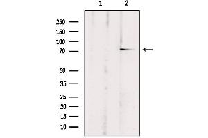 Western blot analysis of extracts from rat brain, using ABCB10 Antibody. (ABCB10 antibody  (Internal Region))