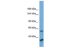 Host:  Rabbit  Target Name:  OSBP2  Sample Type:  OVCAR-3 Whole cell lysates  Antibody Dilution:  1. (OSBP2 antibody  (N-Term))
