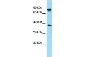 WB Suggested Anti-HOOK3 Antibody Titration: 1. (HOOK3 antibody  (C-Term))