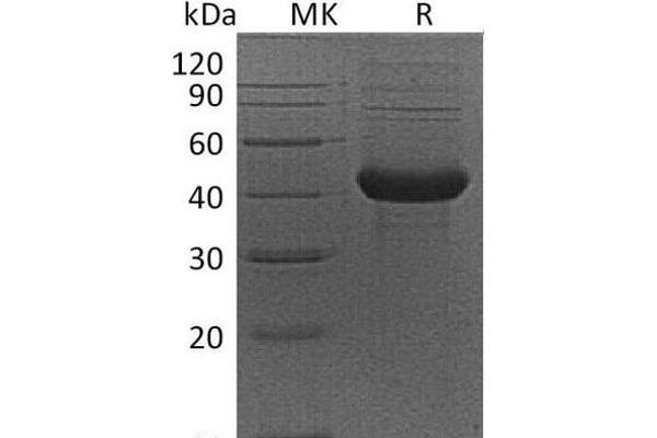 Activin A Receptor Type IB/ALK-4 Protein (Fc Tag)
