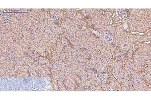 Immunohistochemistry of paraffin-embedded Rat kidney tissue using CD5 Monoclonal Antibody at dilution of 1:200. (CD5 antibody)