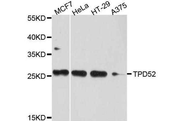 TPD52 antibody  (AA 1-184)