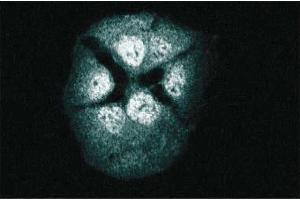 Immunofluorescence staining of A431 cells. (RAP1 antibody  (AA 1-184))