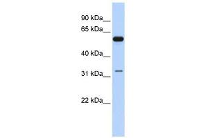 DDX28 antibody used at 1 ug/ml to detect target protein.
