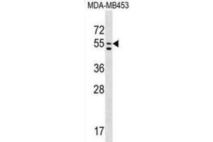 Western Blotting (WB) image for anti-phosphatidylserine Synthase 1 (PTDSS1) antibody (ABIN2999231)